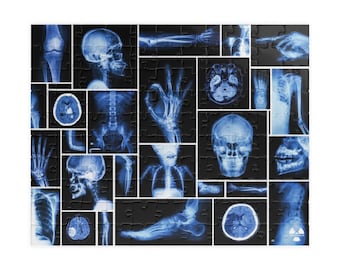 Radiology Jigsaw Puzzle (110, 252, 500-piece)