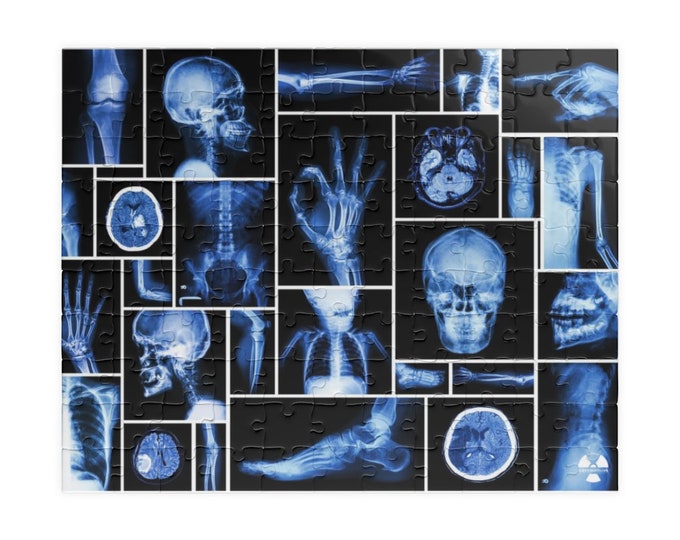 Radiology Jigsaw Puzzle (110, 252, 500-piece)