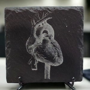 Cardiology Coasters: Celebrate the Wonders of the Human Heart with our Laser-Engraved Slate Set of 4 Coasters, Medical Student Gift