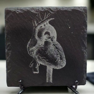 Cardiology Coasters: Celebrate the Wonders of the Human Heart with our Laser-Engraved Slate Set of 4 Coasters, Medical Student Gift