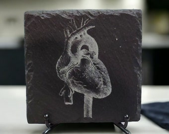 Cardiology Coasters: Celebrate the Wonders of the Human Heart with our Laser-Engraved Slate Set of 4 Coasters, Medical Student Gift