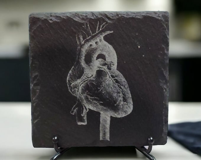 Cardiology Coasters: Celebrate the Wonders of the Human Heart with our Laser-Engraved Slate Set of 4 Coasters, Medical Student Gift