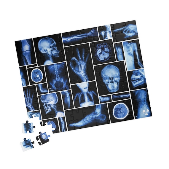 Radiology Jigsaw Puzzle: X-ray, MRI, CT Scan Tech Gift - Etsy