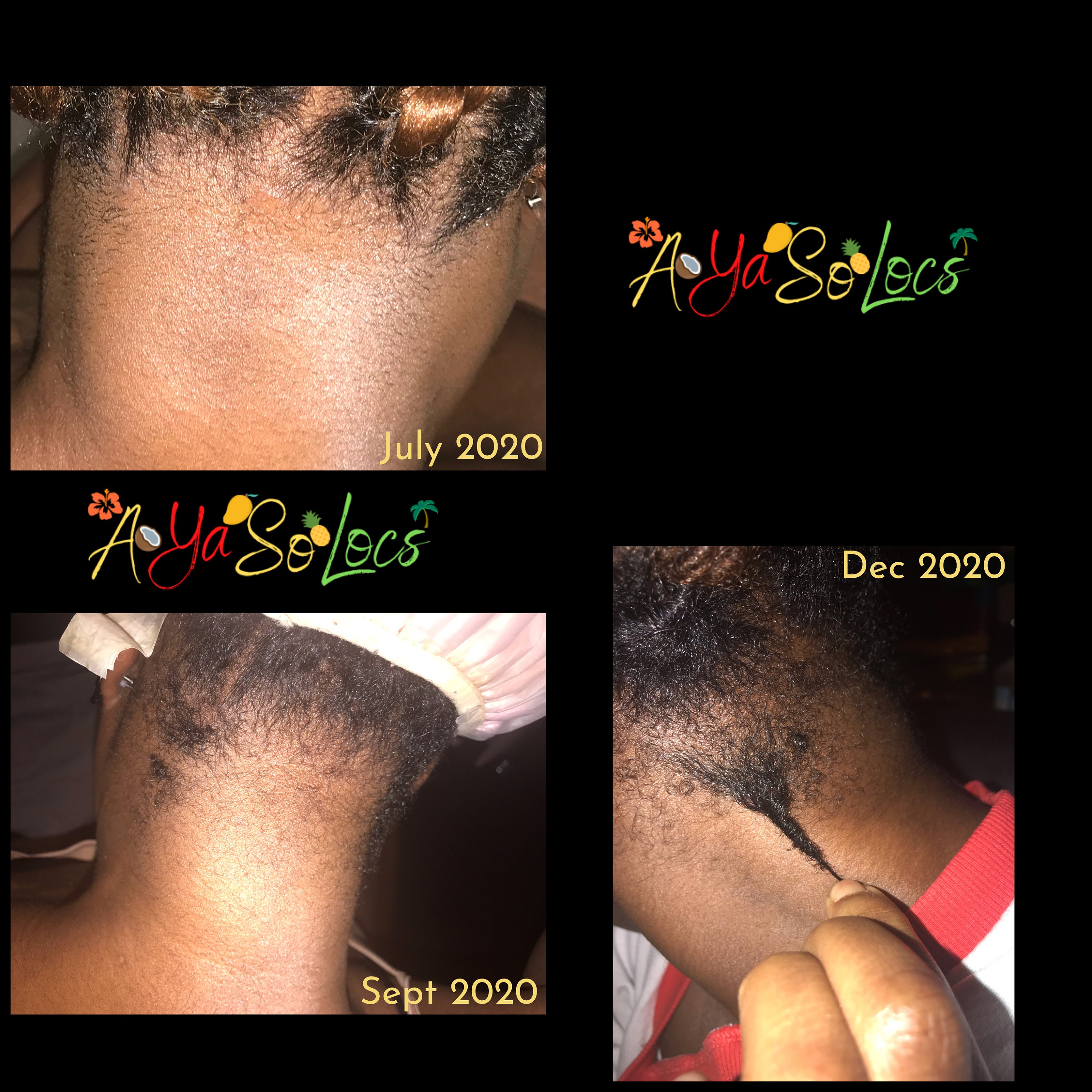 Dreadlocks/Loc Scalp Therapy Oil Etsy