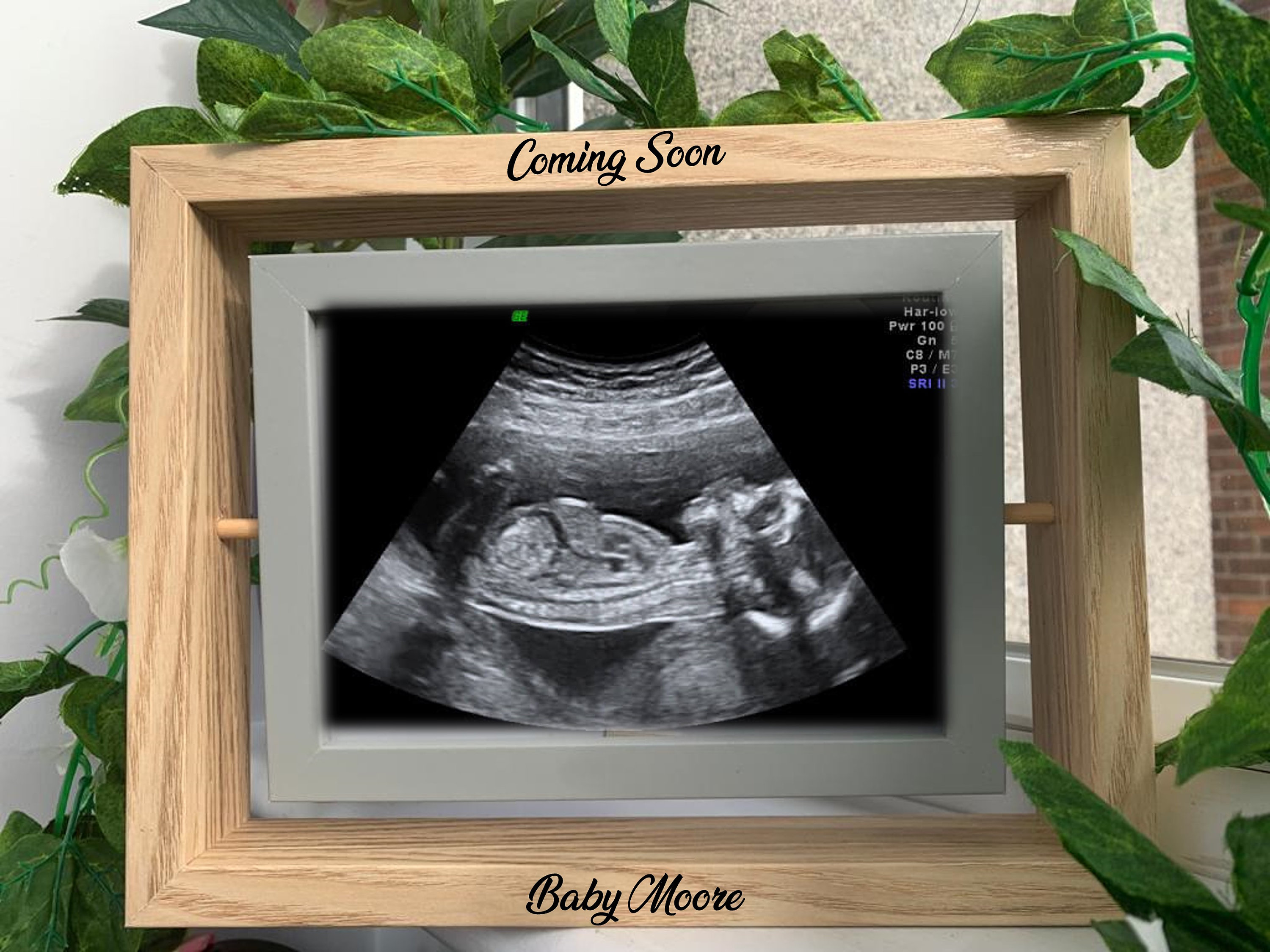 Baby Scan Photo Frame Plaque First Picture Wooden with Messages Home Decor New 