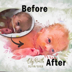 Angel Baby Infant Loss Gift, Baby Loss Restoration, Miscarriage Gift Loved One, Customised Memorial Stillbirth Photo, Erase Tubes on Face,