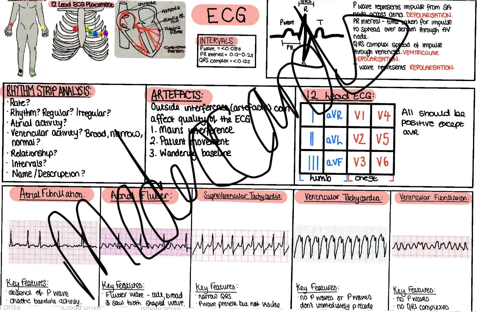 ECG Reference Poster - Etsy
