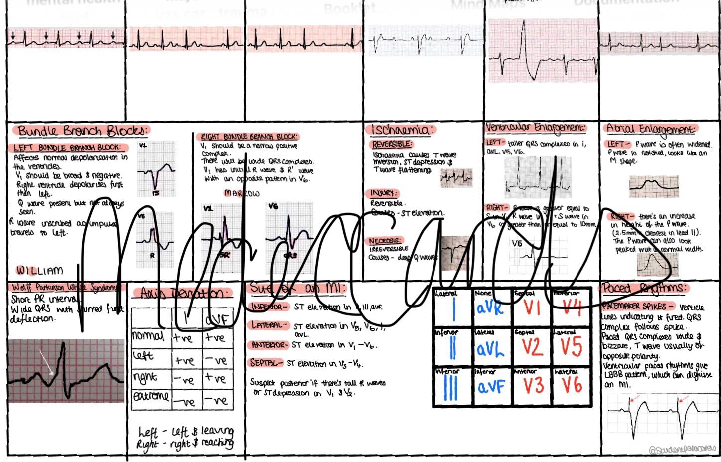 ECG Reference Poster - Etsy