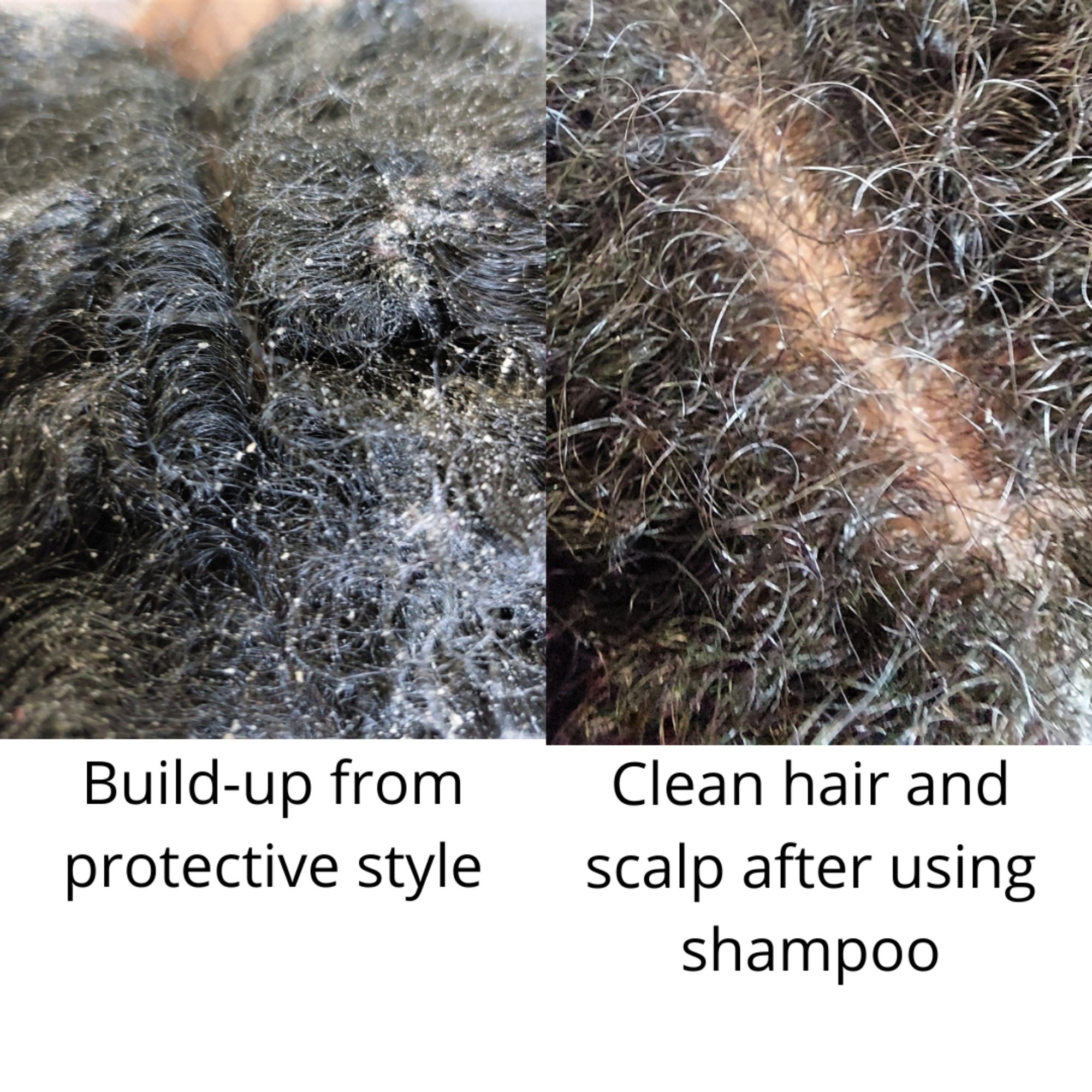 Clarifying Scalp and Hair Shampoo Build up Removal Scalp - Etsy Ireland Clarifying Scalp and Hair Shampoo Build up Removal Scalp - Etsy Ireland