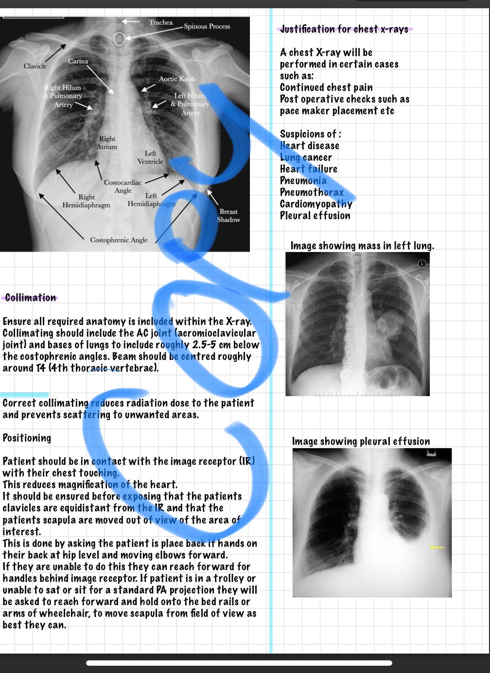 Chest Xray Interpretation and Beginners Anatomy Etsy