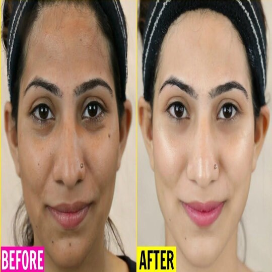 Effective Glutathione Face Cream dark Spots Face Cream 60ml Etsy