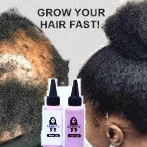 Buy Fenugreek Herbal Hair Growth Oil Mega Hair Growth Prevents Online in India - Etsy Buy Fenugreek Herbal Hair Growth Oil Mega Hair Growth Prevents Online in India - Etsy