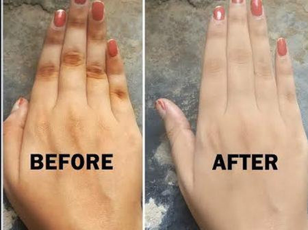 Dark Knuckle Remover Cream /exfoliating Scrub / Knuckle Cleanser