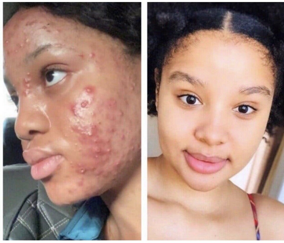 Effective Glutathione Face Cream dark Spots Face Cream 60ml Etsy