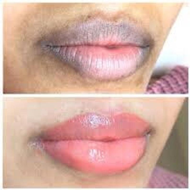 Extreme lip lightening Cream and Strawberry Lip scrub Bundle Etsy