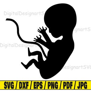 Può includere: Silhouette nera di un feto in posizione fetale con un cordone ombelicale.