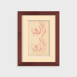 1880s Female Reproductive Anatomy Original Antique Print | Victorian Lithographic Women&#39;s Medical Illustration Wall Art, Gynecology Decor