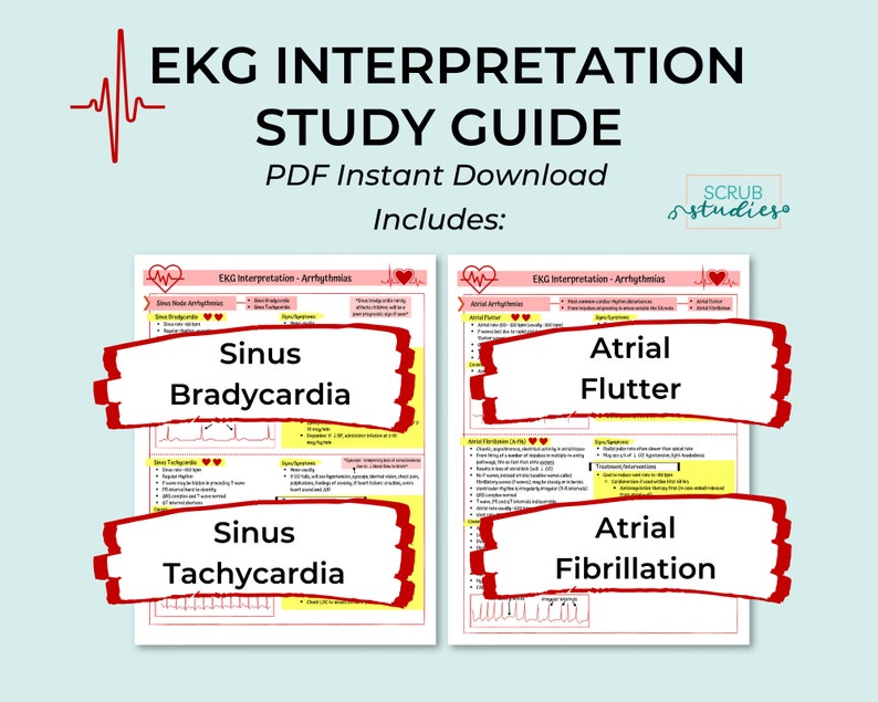 EKG Interpretation Study Guide | EKG Arrhythmias | ECG | Nursing ...