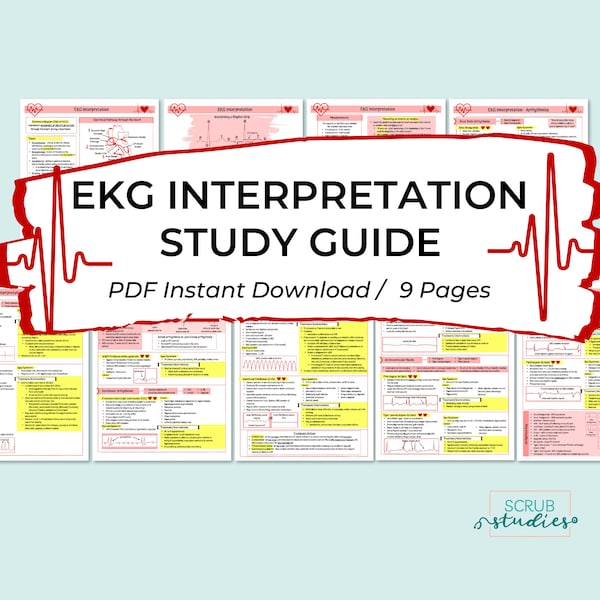 EKG Interpretation Studienführer | EKG Arrhythmien | EKG | Krankenpflege Schüler Notizen | Digitaler Download