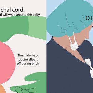 May include: Illustration of a baby with a purple umbilical cord wrapped around its neck. A gloved hand is shown gently slipping the cord off the baby's neck. The text 'N is for nuchal cord. Sometimes the umbilical cord will wrap around the baby. The midwife or doctor slips it off during birth.' is also included.