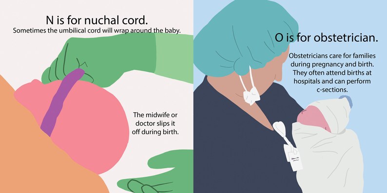 May include: Illustration of a baby with a purple umbilical cord wrapped around its neck. A gloved hand is shown gently slipping the cord off the baby's neck. The text 'N is for nuchal cord. Sometimes the umbilical cord will wrap around the baby. The midwife or doctor slips it off during birth.' is also included.
