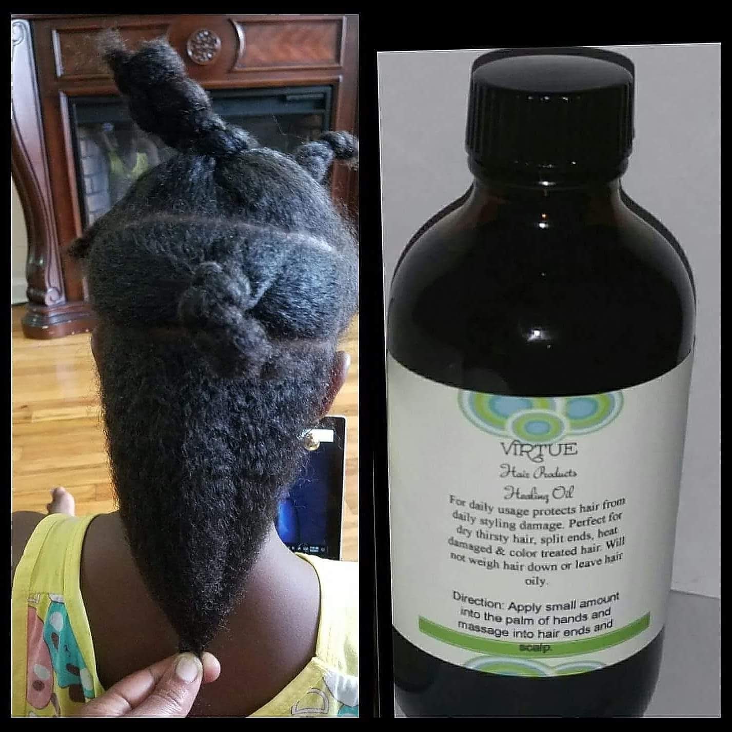 Hair Loss Alopecia Hair Care Healing Oil 2 Oz Etsy