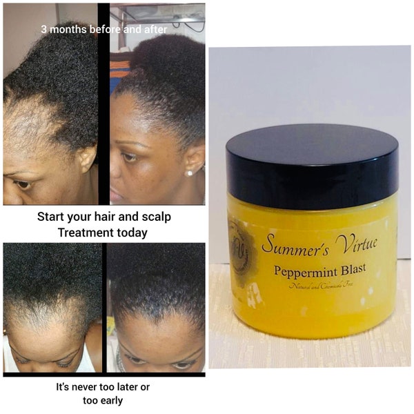 Peppermint blast (Bald spots, Damaged edges, Hair growth, Hair loss, Hair Scrum, Stunted Growth, Hair Growth Butter, Thinning hair)