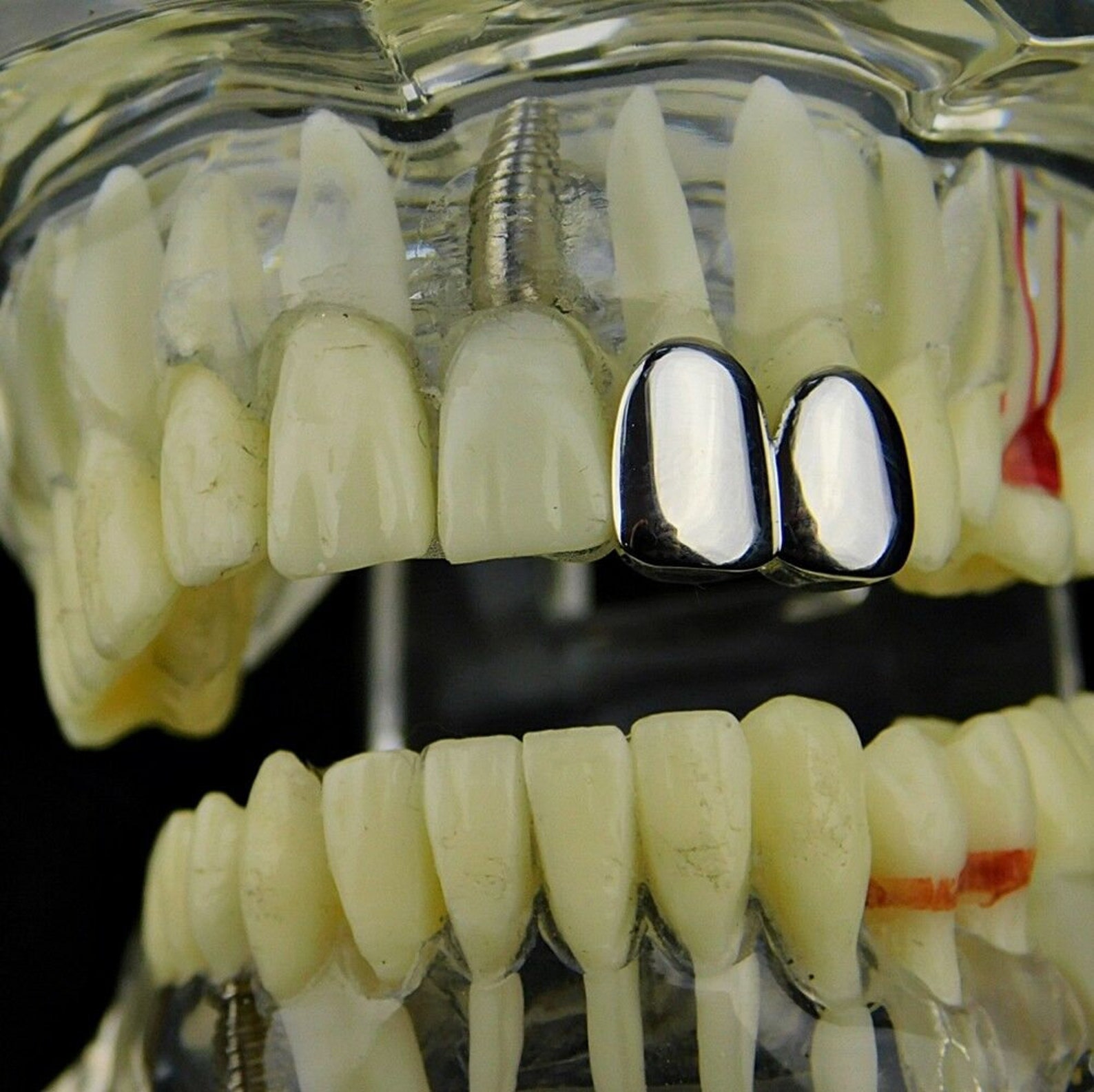 Double Cap Grillz Silver Tone Top Two Left K9 Teeth Grill Hip Etsy