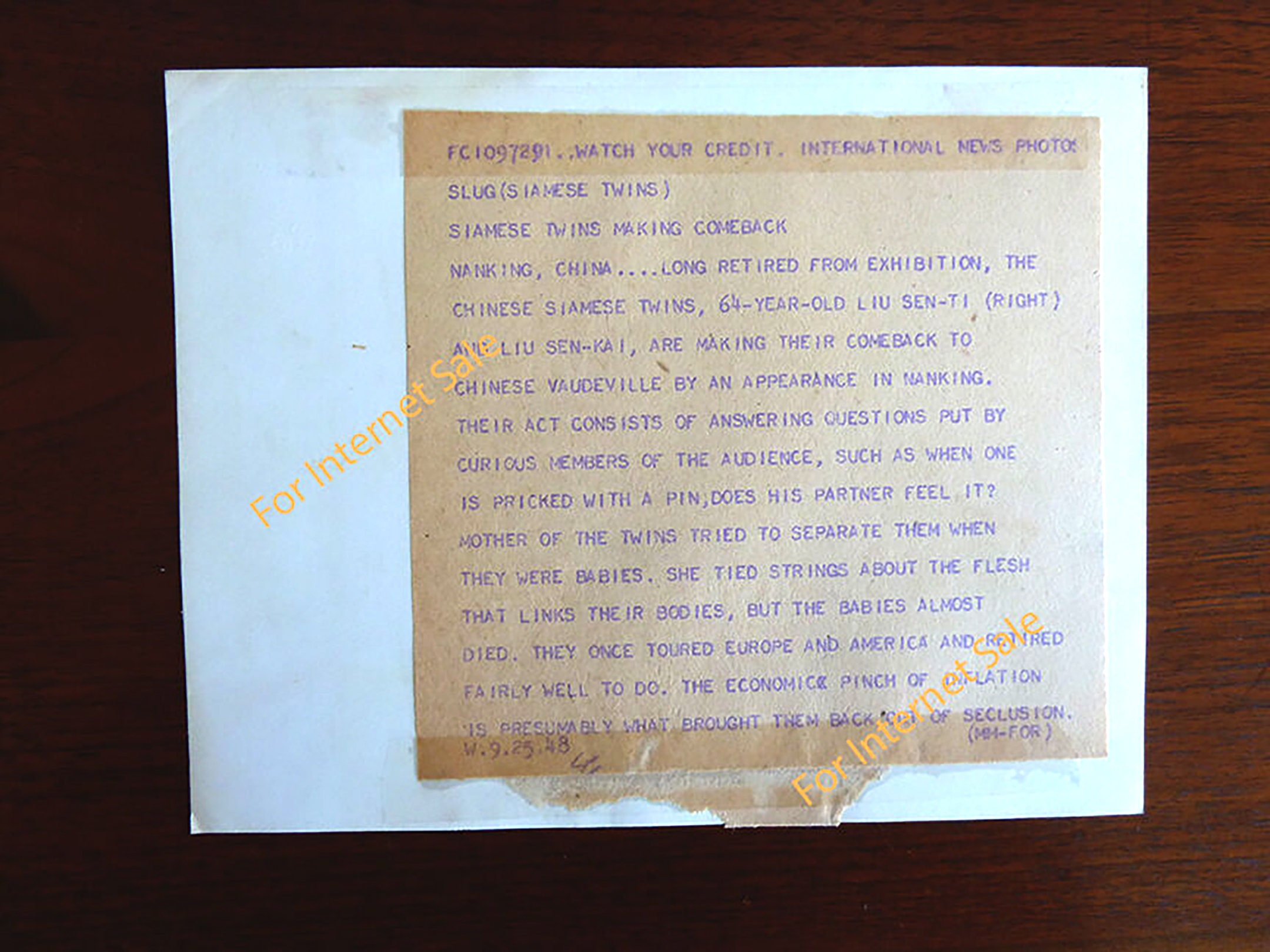 Rare 1948 Chinese Conjoined Siamese Twins Nude, Naked Torso Press Photo