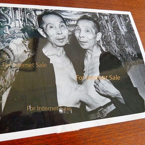Rare 1948 Chinese Conjoined Siamese Twins Nude, Naked Torso Press Photo