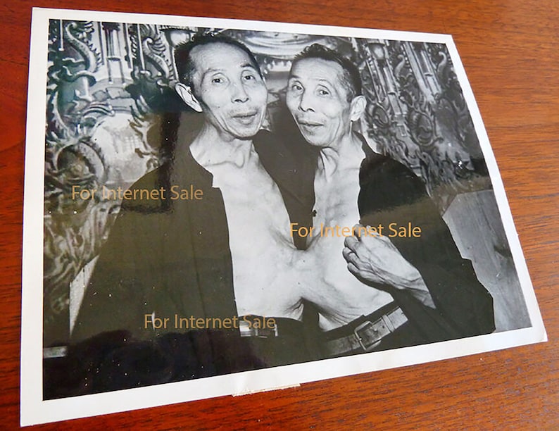 Rare 1948 Chinese Conjoined Siamese Twins Nude, Naked Torso Press Photo