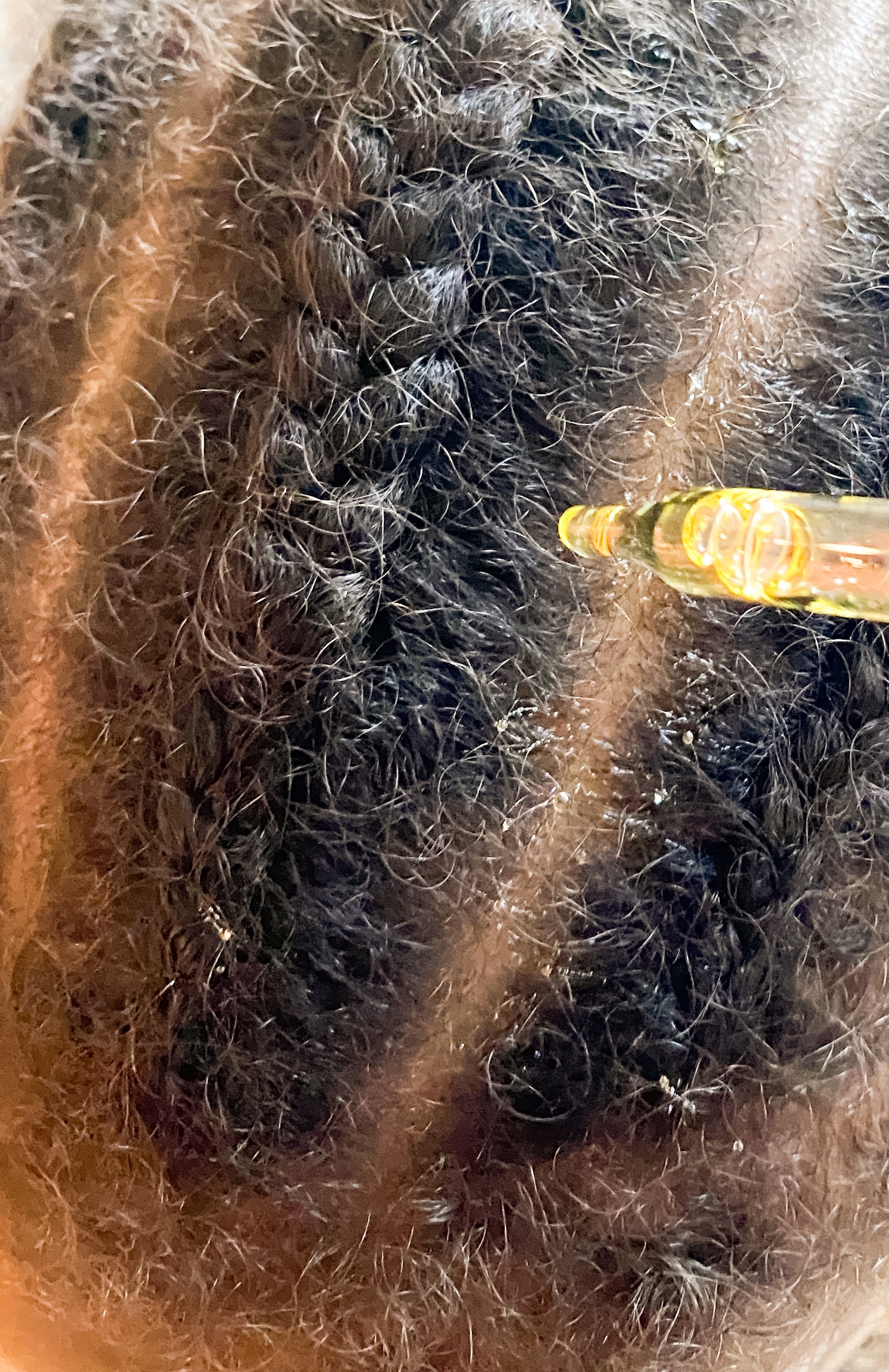 Cradle Cap Oil, Scalp Oil for Cradle Cap, Dry Scalp, Dandruff. Baby Scalp Oil for Cradle Cap