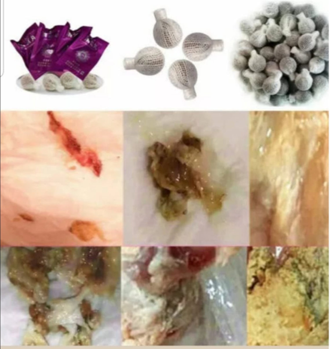 Before And After Yoni Pearls Cleanse Results