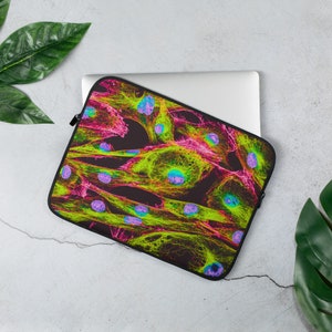 Op de afbeelding: Een laptophuls met een levendig, abstract ontwerp met een close-up van cellen in een felgroen, roze en blauw kleurenschema.