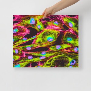 Op de afbeelding: Microscopische afbeelding van cellen die in levendige roze, groene en blauwe tinten zijn gekleurd. De cellen zijn met elkaar verbonden door een netwerk van dunne, felgroene lijnen. De afbeelding is een close-up van de celstructuur.