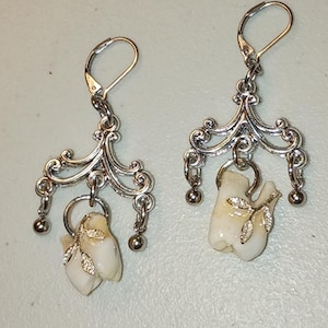 May include: A pair of silver chandelier earrings with a dental theme. Each earring features a decorative silver filigree design with a small, realistic-looking tooth pendant. The earrings have a lever-back closure.