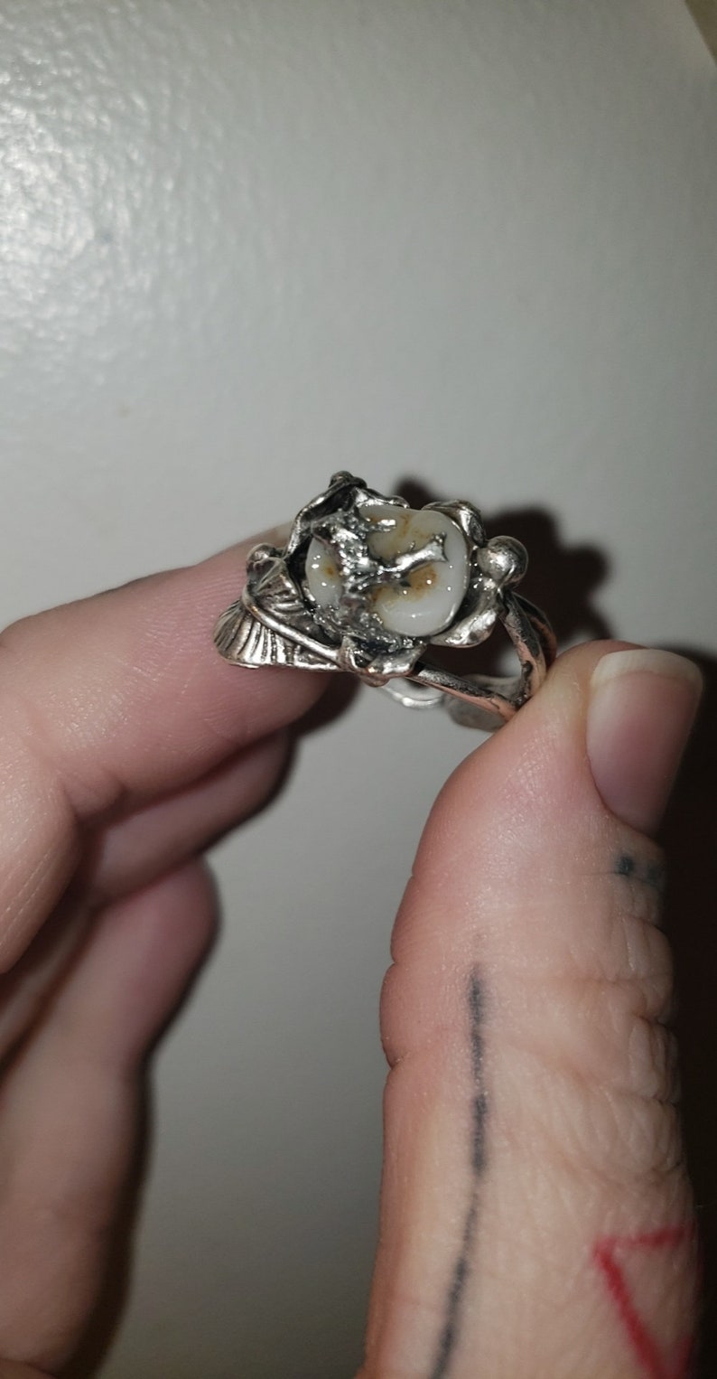 Solder cavity filling flower cup ring. Tooth ring. Teeth ring. Molar ring.