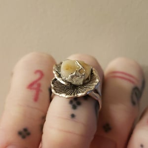 Solder cavity filling tooth ring on mushroom setting. Teeth ring. Molar ring.
