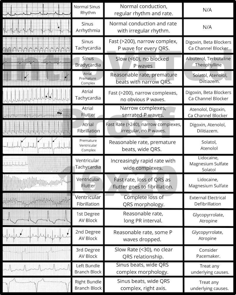 Recover Veterinary Rythym Chart Veterinary ECG Chart Digital Download,veterinary Cardiac Chart ...