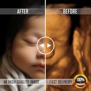 Ultrasound baby, 3D, 4D, 5D and HD Ultrasound, Real View, ultrasound photo, new mom, baby shower gift, unborn baby, ultrasound scan,8k image