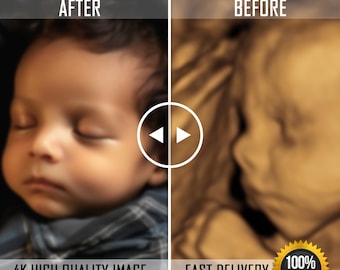 Custom Baby Ultrasound to Real Image: New Mom Gift