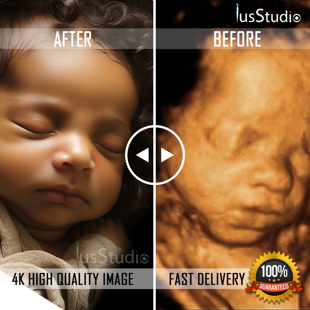 ultrasound-baby-3d-4d-5d-and-hd-ultrasound-real-view-ultrasound