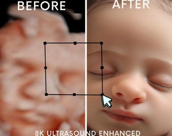 Enhanced Ultrasound Baby Video: 3D, 4D, 5D, HD Real View