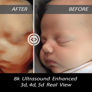 Ultrasound baby, 3D, 4D, 5D and HD Ultrasound, Real View, ultrasound photo, new mom, baby shower gift, unborn baby, ultrasound scan,8k image