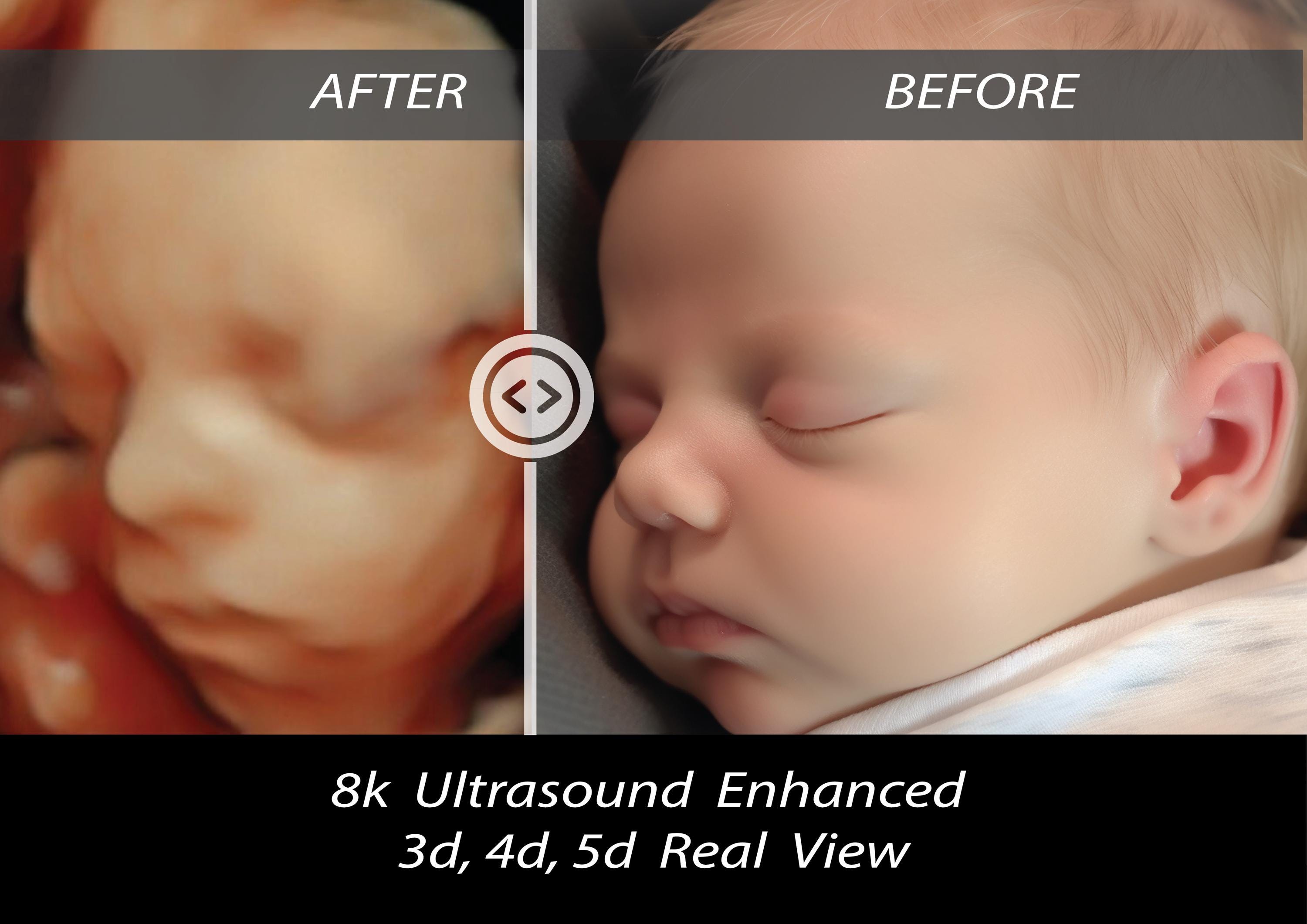 8K Ultrasound Baby Scan: Custom Real View Image, New Mom Gift