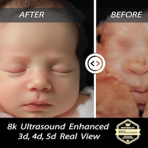 Ultrasound baby, 3D, 4D, 5D and HD Ultrasound, Real View, ultrasound photo, new mom, baby shower gift, unborn baby, ultrasound scan,8k image