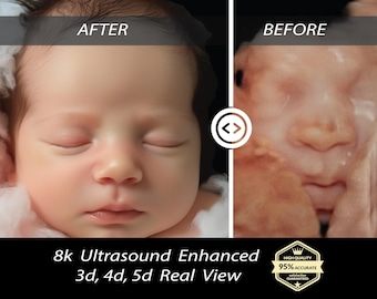 8K Enhanced Ultrasound Baby Image: Custom Real View, New Mom Gift