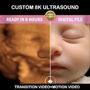 Ultrasound baby Video, 3D, 4D, 5D and HD Ultrasound, Real View, ultrasound photo, new mom, baby shower gift, unborn baby, ultrasound scan