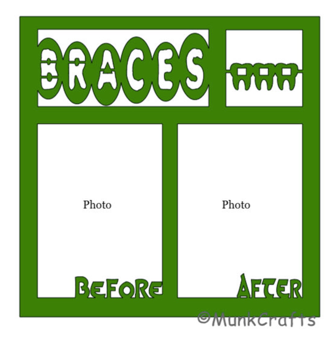 Braces Scrapbook Overlays Digital SVG Files for Cricut/canva Etsy