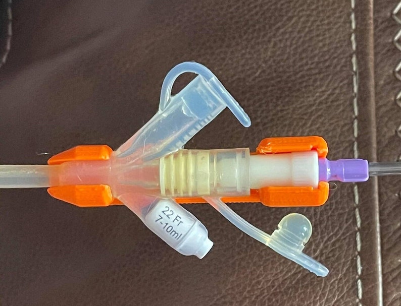 Puede incluir: Primer plano de un cat&eacute;ter IV m&eacute;dico con un tubo de pl&aacute;stico transparente, conectores naranja y morado, y una etiqueta que dice "22 Fr 7-10 ml".